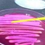 Bactérias multirresistentes são identificadas fora de hospital